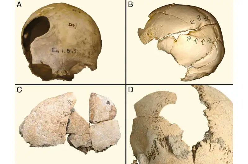  De l'ancienneté de se foutre sur la gueule Sur les squelettes de plus de 2300 agriculteurs néolithiques provenant de 180 sites datant d'il y a environ 8000 à 4000 ans, plus d'1 sur 10 présentent des blessures par arme