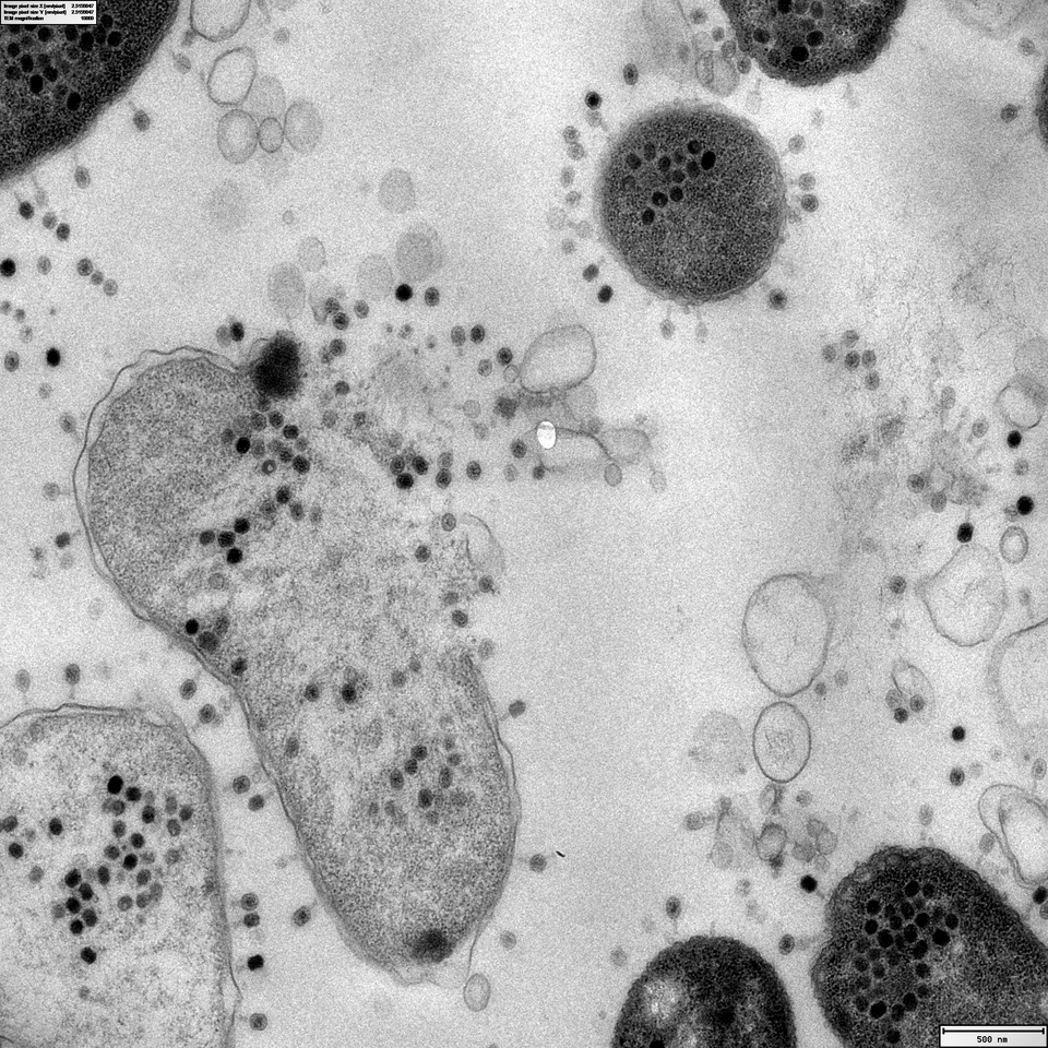 Atchoum : splendide photographie au microscope électronique d'une bactérie E. coli en lyse relâchant dans le milieu des centaines de virus bactériophages