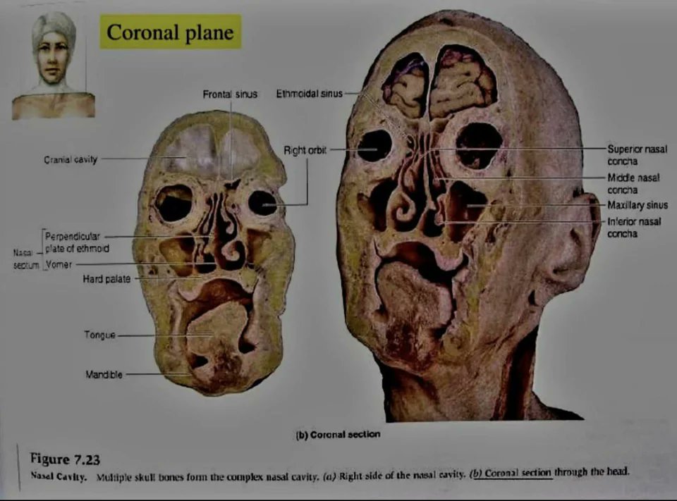 Nightmare Fuel : cette coupe coronale d'une tête humaine... Notez les zigouigoui dans la cavité nasale : les cornets nasaux 