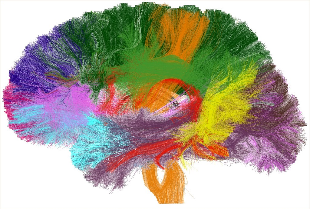 Représentation de 38 faisceaux longs de la substance blanche cérébrale (chaque couleur code 1 faisceau) obtenus en IRM de diffusion ©CEA/Neurospin