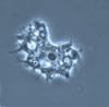 Naegleria Fowleri