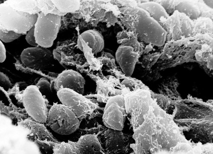 Groupe de Bactéries Yersinia pestis vues au microscope électronique à balayage