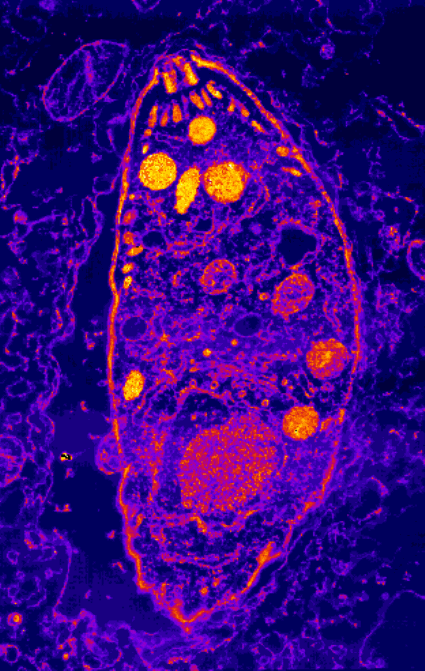 Toxoplasma gondii en microscopie électronique, fausses couleurs