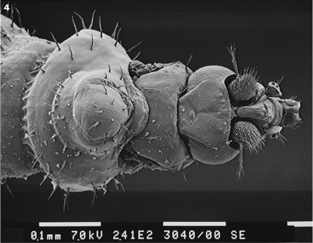 Vue de dessus de la tête, thorax et premier segment abdominal d'une femelle Vestigipoda maschwitzi, Miscroscope électronique