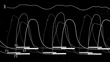 Extrait de Marey, EJ (1873) La Machine Animale. Locomotion terrestre et aérienne Extrait de Marey, EJ (1873) La Machine Animale. Locomotion terrestre et aérienne