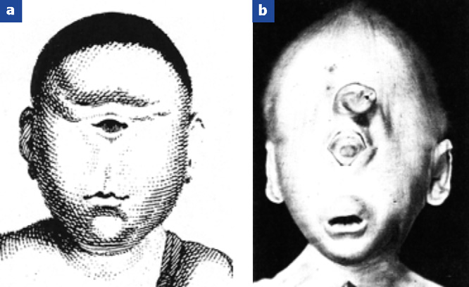 Fischer JL. Monstres. Histoire du corps et de ses défauts. Paris: Syros/Alternatives; 1991. Fischer JL. Monstres. Histoire du corps et de ses défauts. Paris: Syros/Alternatives; 1991.