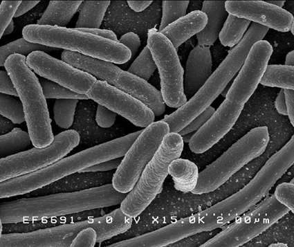 Escherichia coli au Microscope Electronique à Balayage