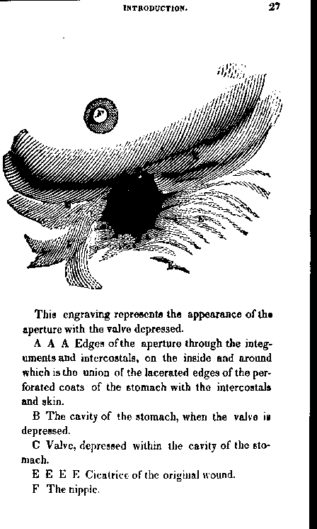 Extrait de l'ouvrage de Beaumont intitulé « Expériences et observations sur le suc gastrique et la physiologie de la digestion », 1833 (p. 27)