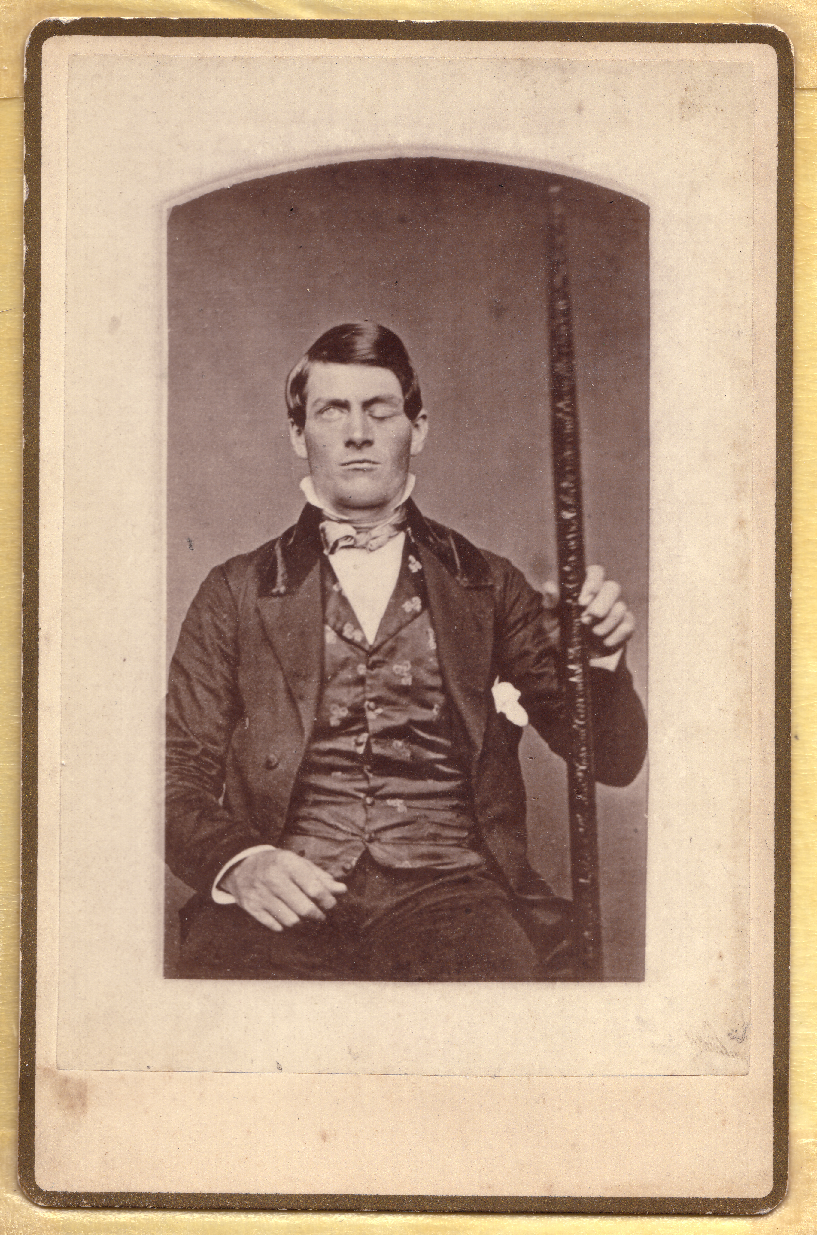 Portrait au format « cabinet card » de Phineas P. Gage (1823-1860), survivant d’une lésion cérébrale, représenté tenant la tige de compactage qui l’avait blessé. Tiré de la collection photographique de la famille Gage du Texas. Une image identique est en possession de Phyllis Gage Hartley, du New Jersey. Un daguerréotype étant presque toujours inversé latéralement (gauche-droite), une seconde inversion compensatoire a été appliquée pour produire cette image, afin de montrer Gage tel qu’il était de son vivant ; le fait que cette image représente correctement Gage est confirmé par des rapports médicaux contemporains décrivant ses blessures, ainsi que par les lésions visibles sur le crâne de Gage, qui est encore conservé. Portrait au format « cabinet card » de Phineas P. Gage (1823-1860), survivant d’une lésion cérébrale, représenté tenant la tige de compactage qui l’avait blessé. Tiré de la collection photographique de la famille Gage du Texas. Une image identique est en possession de Phyllis Gage Hartley, du New Jersey. Un daguerréotype étant presque toujours inversé latéralement (gauche-droite), une seconde inversion compensatoire a été appliquée pour produire cette image, afin de montrer Gage tel qu’il était de son vivant ; le fait que cette image représente correctement Gage est confirmé par des rapports médicaux contemporains décrivant ses blessures, ainsi que par les lésions visibles sur le crâne de Gage, qui est encore conservé.